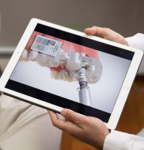 doctor showing patient dental implants video, Falmouth, MA