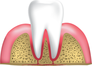 healthy gums and tooth, Falmouth, MA